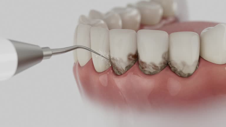 Trusted Teeth Cleaning And Checkup service in Mazon, IL - Dentist Open Now